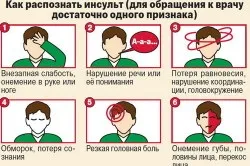 Інсульт у дітей причини і симптоми