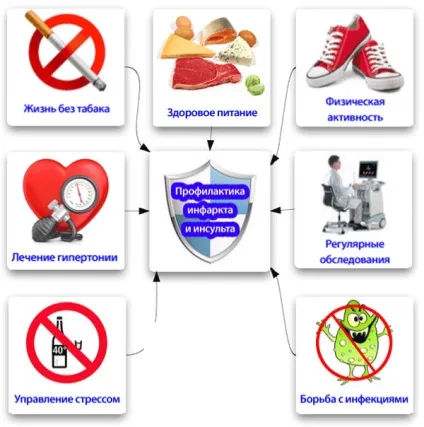 Інфаркт після інсульту - наслідки, життя (після) Інфаркт після інсульту - наслідки, життя