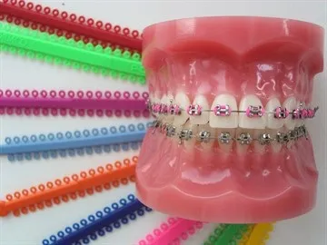 Виправлення прикусу у дітей пластина, трейнер, капа і брекети для виправлення непрваліного прикусу (трейнер для виправлення прикусу у дітей купити) Виправлення прикусу у дітей пластина, трейнер, капа і брекети для виправлення непрваліного прикусу