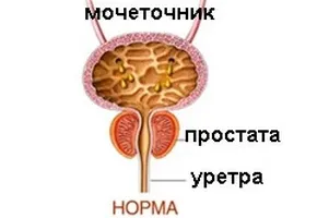 Які симптоми можуть вказувати на аденому простати (простати) Які симптоми можуть вказувати на аденому простати