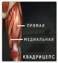 Вправи для квадрицепсов, силові вправи (вправи) Вправи для квадрицепсов, силові вправи