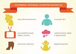 Як уникнути варикозу на ногах запобігти або зупинити варикоз (ногах) Як уникнути варикозу на ногах запобігти або зупинити варикоз