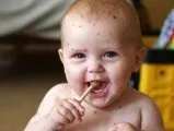 Яке масло від рубців і шрамів варто придбати і використовувати (масло) Яке масло від рубців і шрамів варто придбати і використовувати