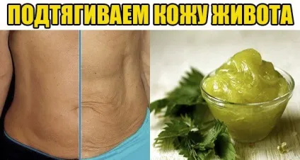 Як підтягнути в'ялу шкіру на животі (шкіру) Як підтягнути в'ялу шкіру на животі