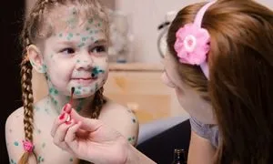 Як приготувати шарлотку з яблуками в духовці 2 класичних і 2 кисломолочних рецепта (приготувати шарлотка яблука духовка рецепт випікати спекти деко силіконовий форма) Як приготувати шарлотку з яблуками в духовці 2 класичних і 2 кисломолочних рецепта