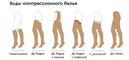 Як запобігти і уникнути варикоз на ногах