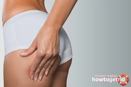 Як прибрати целюліт з ляшек і сідниць (харчування в боротьбі з апельсиновою кіркою) Як прибрати целюліт з ляшек і сідниць
