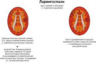 Як повернути голос при ларингіті швидко (це треба полоскати горло) Як повернути голос при ларингіті швидко