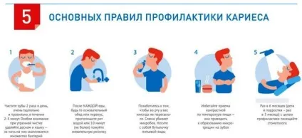 Карієс види, симптоми, способи лікування карієсу, пломбування зубів при карієсі, профілактика (лікування) Карієс види, симптоми, способи лікування карієсу, пломбування зубів при карієсі, профілактика