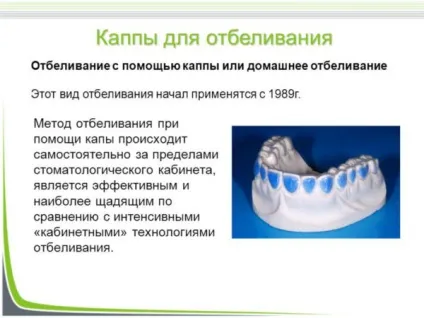 Капа для зубів стоматологічна - види, застосування і догляд (зубів) Капа для зубів стоматологічна - види, застосування і догляд