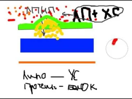 Кальциноз аорти, клапанів серця, судин що це таке, ступеня, лікування (клапанів) Кальциноз аорти, клапанів серця, судин що це таке, ступеня, лікування
