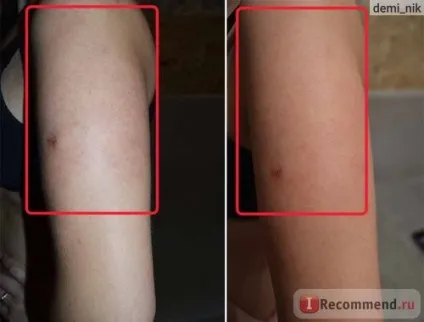 Вакуумно-роликовий масаж на апараті slimming d-528 - «вакуумно-роликовий масаж в салоні - фото (апараті) Вакуумно-роликовий масаж на апараті slimming d-528 - «вакуумно-роликовий масаж в салоні - фото