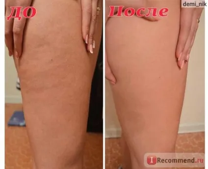 Вакуумно-роликовий масаж на апараті slimming d-528 - «вакуумно-роликовий масаж в салоні - фото (апараті) Вакуумно-роликовий масаж на апараті slimming d-528 - «вакуумно-роликовий масаж в салоні - фото