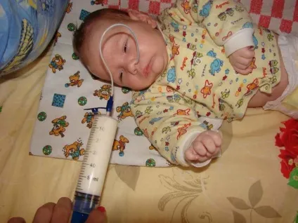 Годування новонародженого через зонд - коли це необхідно відео (дітей першого року) Годування новонародженого через зонд - коли це необхідно відео