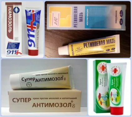 Кров'яна мозоль - причини, професійне видалення, медикаментозні і народні засоби,