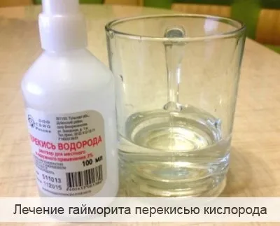 Лікування гаймориту перекисом водню по Неумивакіна (лікування гаймориту перекисом водню по Неумивакіна) Лікування гаймориту перекисом водню по Неумивакіна