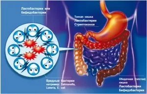 Ліки при запалення кишечника лікування, що робити (кишечника) Ліки при запалення кишечника лікування, що робити