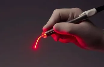 Лікування тонзиліту лазером - докладний опис процедури