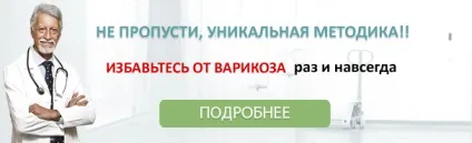 Лікування тромбофлебіту лазером операція, лікування варикозу (тромбофлебіту) Лікування тромбофлебіту лазером операція, лікування варикозу