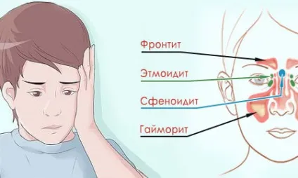 Лікування риносинусита у дітей (дітей) Лікування риносинусита у дітей