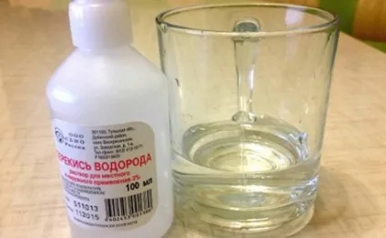 Лікування перекисом водню по Неумивакіна (лікування) Лікування перекисом водню по Неумивакіна