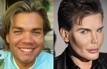 Люди-ляльки, які витратили купу грошей на пластику (28 фото)