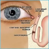 Масаж слізного каналу при дакриоцистите (масаж) Масаж слізного каналу при дакриоцистите