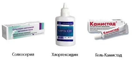 Мазь для ясен при прорізуванні зубів, хворобах ясен, запаленні (ясен) Мазь для ясен при прорізуванні зубів, хворобах ясен, запаленні