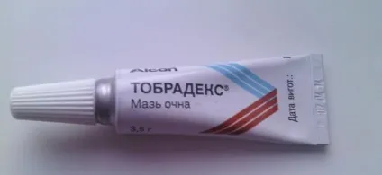 Мазі від кон'юнктивіту (Побічні явища печіння) Мазі від кон'юнктивіту