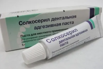 Мазь від пародонтозу або гель що вибрати, огляд засобів (гель) Мазь від пародонтозу або гель що вибрати, огляд засобів