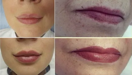 Мікроблейдінг губ - поняття про процедуру і чим вона відрізняється від татуажу