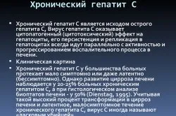 Чи можна працювати з гепатитом с і на яких посадах (гепатитом) Чи можна працювати з гепатитом с і на яких посадах