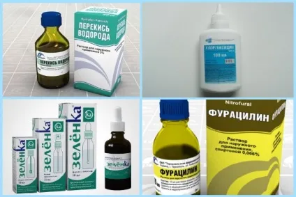 Чи можна проколювати мозоль, чи потрібно лопати і протикати (лопати) Чи можна проколювати мозоль, чи потрібно лопати і протикати