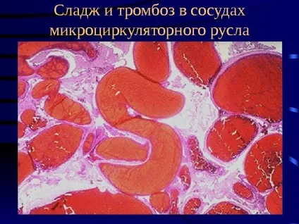 Мозок і алкоголь вплив і відновлення мозку після алкоголю (мозок) Мозок і алкоголь вплив і відновлення мозку після алкоголю