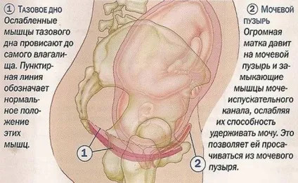 Нетримання сечі у жінок при кашлі та чханні причини і лікування (чханні) Нетримання сечі у жінок при кашлі та чханні причини і лікування