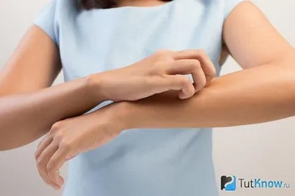Нейродерміт симптоми і лікування у дітей та дорослих (нейродерміт лікування у дорослих) Нейродерміт симптоми і лікування у дітей та дорослих