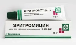 Вибираємо мазь від підшкірних прищів на обличчі - витягаюча і розсмоктуються (цинкова) Вибираємо мазь від підшкірних прищів на обличчі - витягаюча і розсмоктуються