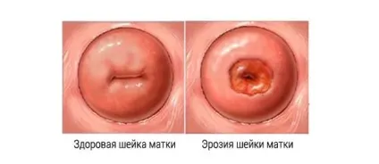 Масло обліпихи в гінекології застосування, лікувальні властивості та протипоказання (застосування) Масло обліпихи в гінекології застосування, лікувальні властивості та протипоказання