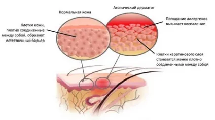 Обгортання з корицею для схуднення рецепти обгортань корицею, відгуки (обгортання з корицею для схуднення) Обгортання з корицею для схуднення рецепти обгортань корицею, відгуки
