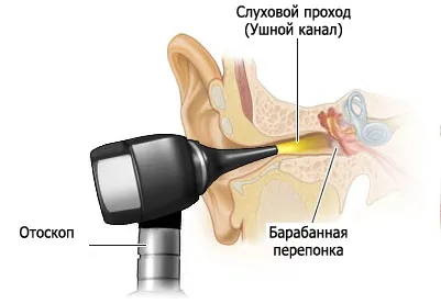Огляд вуха в домашніх умовах