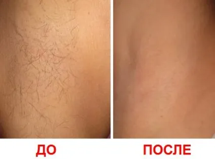 Опис та відгуки про воскових смужках для зони бікіні veet (віт) Опис та відгуки про воскових смужках для зони бікіні veet
