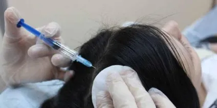 Озонотерапія для волосся опис процедури, показання, відгуки (волосся) Озонотерапія для волосся опис процедури, показання, відгуки