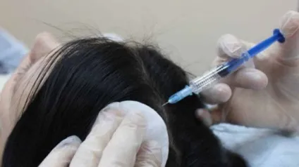 Озонотерапія при випаданні і для стимуляції росту волосся суть, властивості та відгуки про процедуру (волосся) Озонотерапія при випаданні і для стимуляції росту волосся суть, властивості та відгуки про процедуру