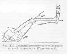 Переломи кісток кінцівок, довідник лікаря (больові скорочення м'язів) Переломи кісток кінцівок, довідник лікаря