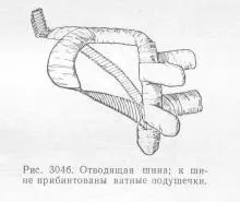 Переломи кісток кінцівок, довідник лікаря (кінцівок) Переломи кісток кінцівок, довідник лікаря