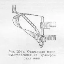 Переломи кісток кінцівок, довідник лікаря (нормальної кісткової мозолі) Переломи кісток кінцівок, довідник лікаря