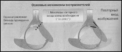 Пароксизмальна тахікардія - студопедія (лекція) Пароксизмальна тахікардія - студопедія
