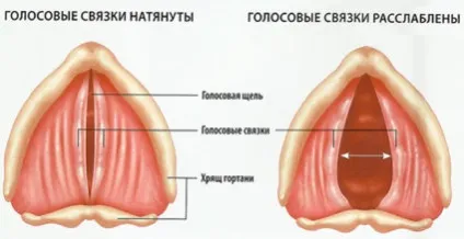 Парез голосових зв'язок, чому так відбувається