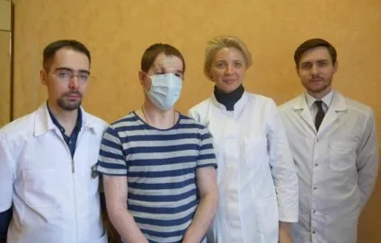Пересадка особи історія, найвдаліші операції (пересадка) Пересадка особи історія, найвдаліші операції