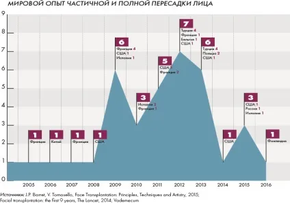 Переміщення особи - журнал vademecum (пересадка органів) Переміщення особи - журнал vademecum